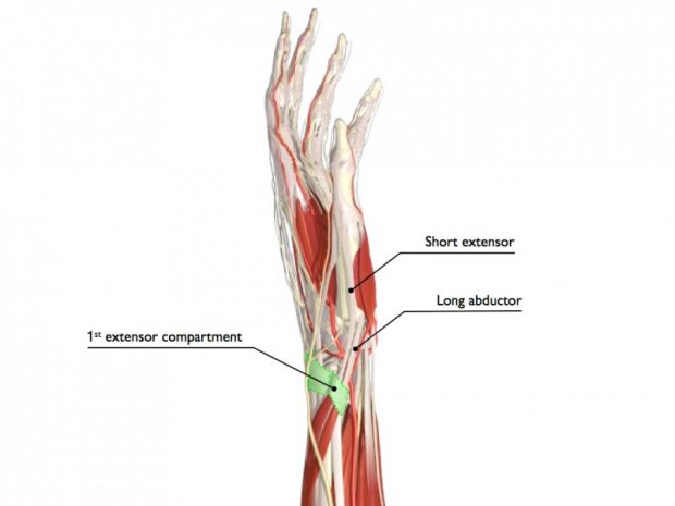 de quervain s tenosynovitis www
